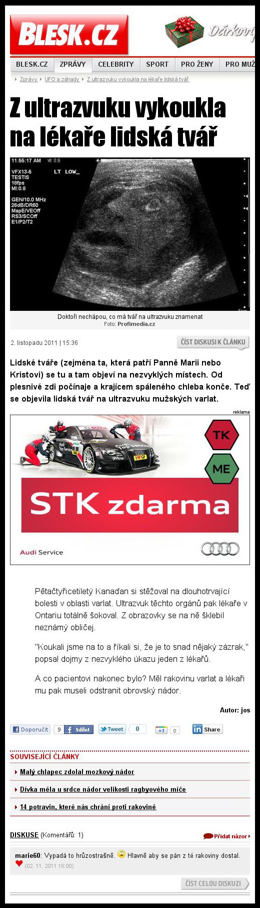 Jak vypad� rakovina na ultrazvuku