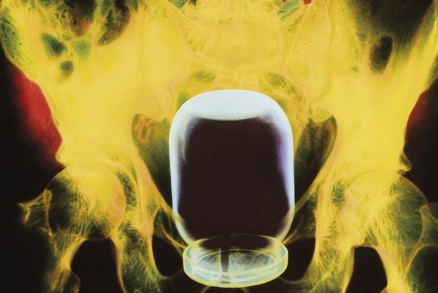 Zava�ova�ka v �iti